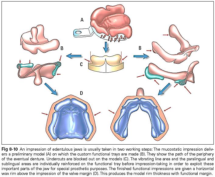 Primary and secondary impressions in complete dentures l removable